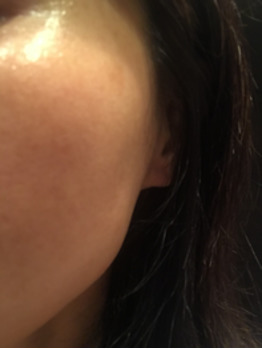 ＠SkinLabo - エンビロンオフィシャル新宿（旧メディケアスキンラボ）