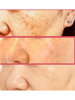 ＠SkinLabo - エンビロンオフィシャル新宿（旧メディケアスキンラボ）