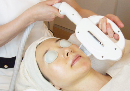 フォトＲＦ，Ｅライト