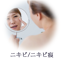 ニキビ/ニキビ痕