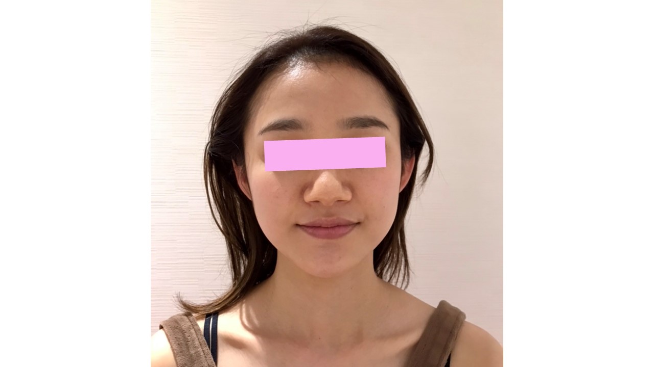 ＠SkinLabo - エンビロンオフィシャル新宿（旧メディケアスキンラボ）