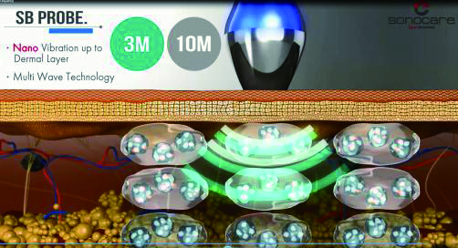 3MHz、10MHzの組み合わせ