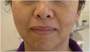 ＠SkinLabo - エンビロンオフィシャル新宿（旧メディケアスキンラボ）