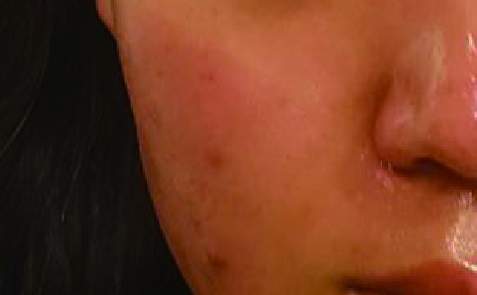 ＠SkinLabo - エンビロンオフィシャル新宿（旧メディケアスキンラボ）