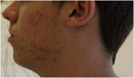 ＠SkinLabo - エンビロンオフィシャル新宿（旧メディケアスキンラボ）