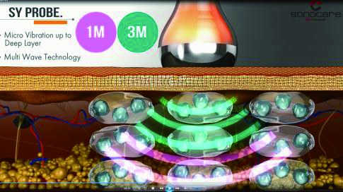 1MHz、3MHzの組み合わせ