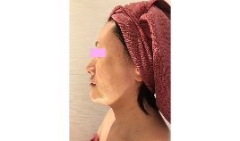 ＠SkinLabo - エンビロンオフィシャル新宿（旧メディケアスキンラボ）