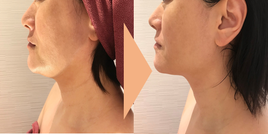 ＠SkinLabo - エンビロンオフィシャル新宿（旧メディケアスキンラボ）