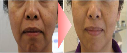 ＠SkinLabo - エンビロンオフィシャル新宿（旧メディケアスキンラボ）