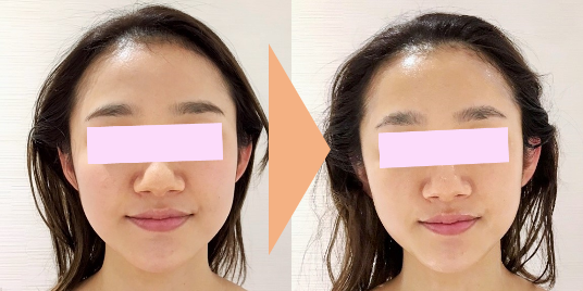 ＠SkinLabo - エンビロンオフィシャル新宿（旧メディケアスキンラボ）