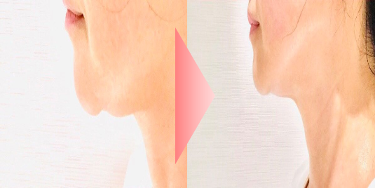 ＠SkinLabo - エンビロンオフィシャル新宿（旧メディケアスキンラボ）