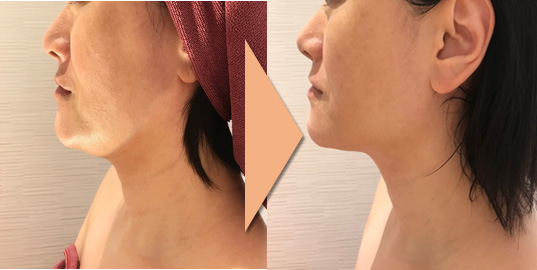 ＠SkinLabo - エンビロンオフィシャル新宿（旧メディケアスキンラボ）