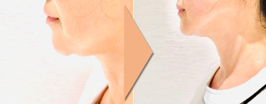 ＠SkinLabo - エンビロンオフィシャル新宿（旧メディケアスキンラボ）