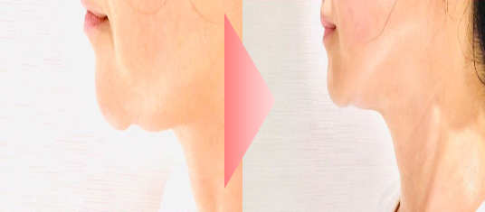 ＠SkinLabo - エンビロンオフィシャル新宿（旧メディケアスキンラボ）